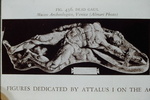Dead Gaul- Museo Archelogico, Venice by James Doan