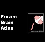 Frozen Brain Atlas by Natalie Andrea Builes, Dominick Joseph Casciato, Samantha Taylor Bergoine, and Robert Charles Speth